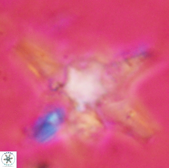 Discoaster bollii 29484