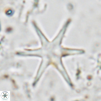 Discoaster brouweri VR 06722