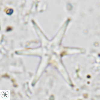 Discoaster brouweri VR 06723