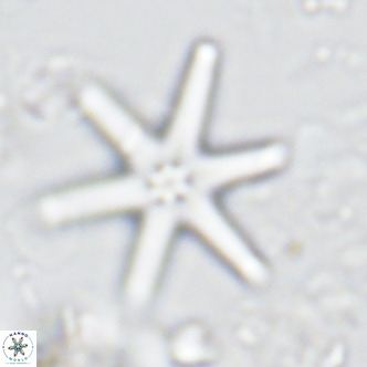 Discoaster brouweri VR 08318