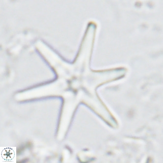 Discoaster brouweri VR 08319