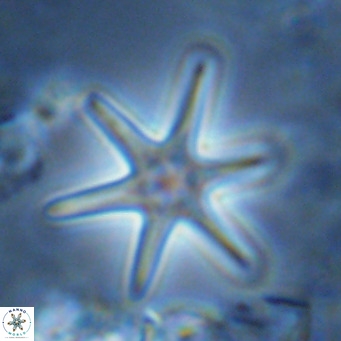 Discoaster brouweri VR 08324
