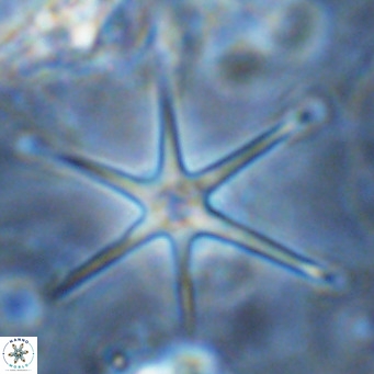 Discoaster brouweri VR 08667