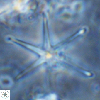 Discoaster brouweri VR 08668