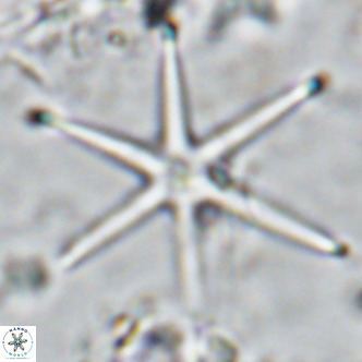 Discoaster brouweri VR 08662