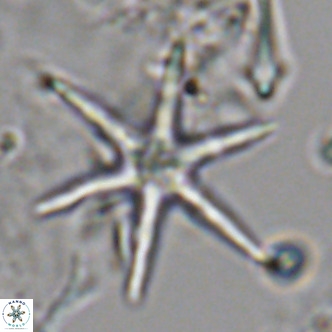 Discoaster brouweri VR 08824