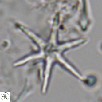 Discoaster brouweri VR 08825