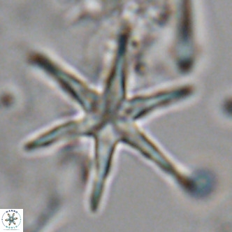 Discoaster brouweri VR 08823