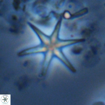 Discoaster brouweri VR 09146