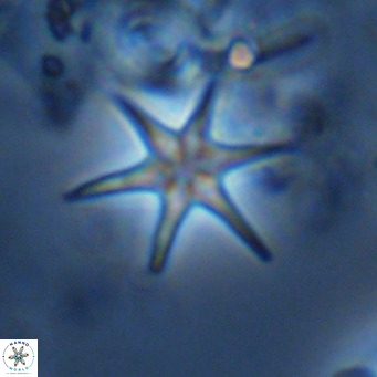 Discoaster brouweri VR 09147