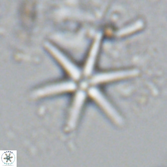 Discoaster brouweri VR 09148
