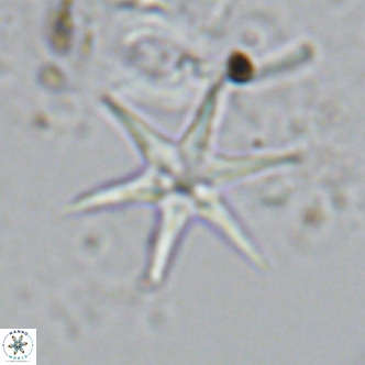 Discoaster brouweri VR 09149