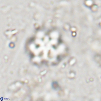 Discoaster catillomicros 29550