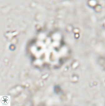 Discoaster catillomicros 29550
