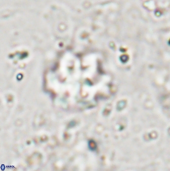 Discoaster catillomicros 29551