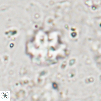 Discoaster catillomicros 29551