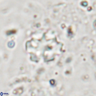 Discoaster catillomicros 29552