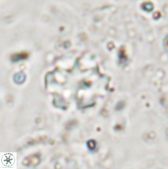 Discoaster catillomicros 29552