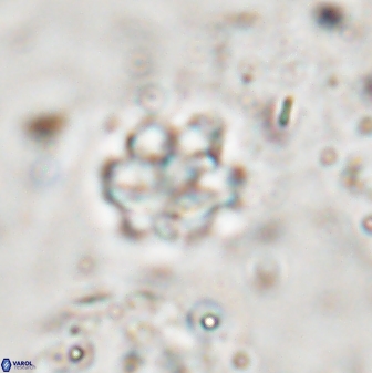 Discoaster catillomicros 29553