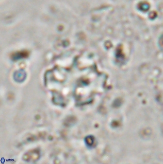 Discoaster catillomicros 29554