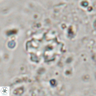 Discoaster catillomicros 29554