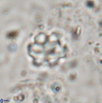 Discoaster catillomicros 29555