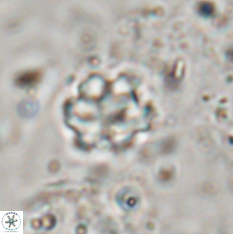 Discoaster catillomicros 29555