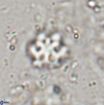 Discoaster catillomicros 29556