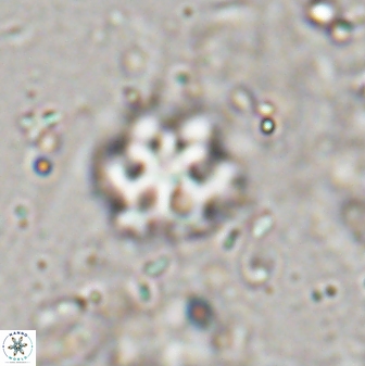Discoaster catillomicros 29556
