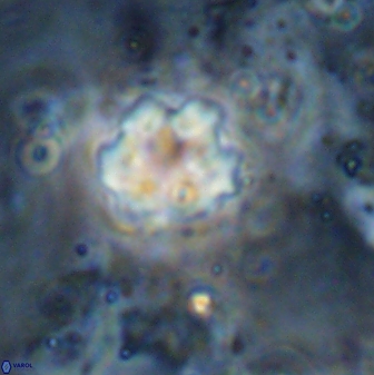 Discoaster catillomicros 29557