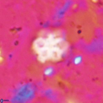 Discoaster catillomicros 29560