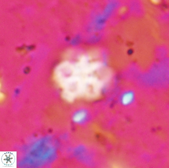 Discoaster catillomicros 29560