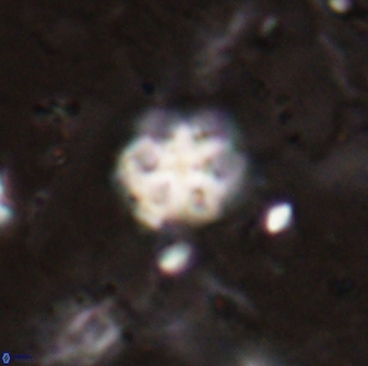 Discoaster catillomicros 29561