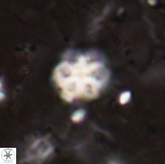 Discoaster catillomicros 29561