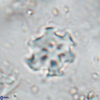 Discoaster catillomicros VR 17982