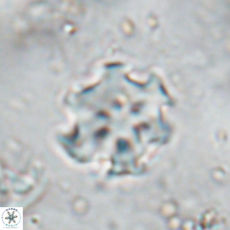 Discoaster catillomicros VR 17982
