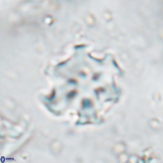 Discoaster catillomicros VR 17983