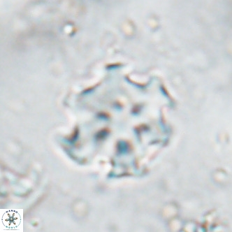 Discoaster catillomicros VR 17983