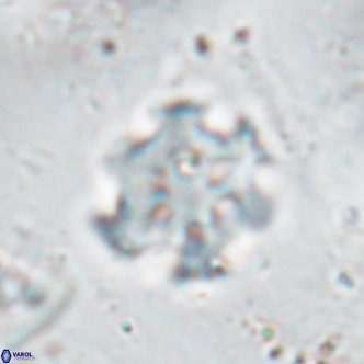 Discoaster catillomicros VR 17984