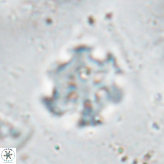 Discoaster catillomicros VR 17984