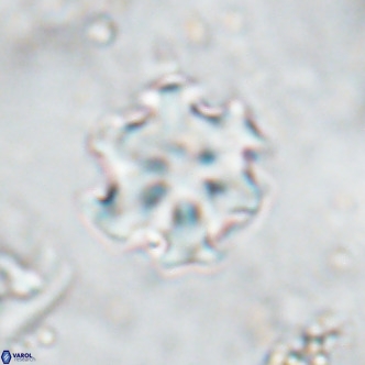 Discoaster catillomicros VR 17987