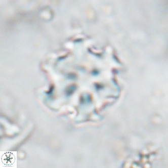 Discoaster catillomicros VR 17987