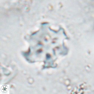 Discoaster catillomicros VR 17988