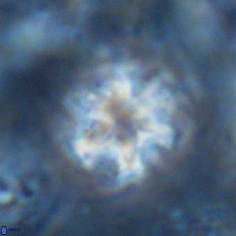 Discoaster catillomicros VR 17989