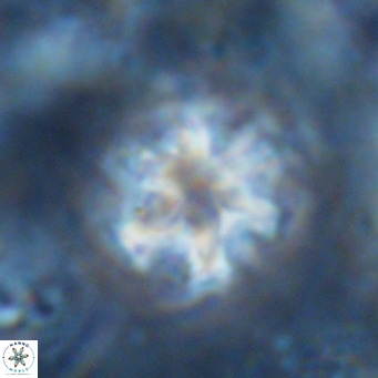 Discoaster catillomicros VR 17989