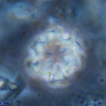 Discoaster catillomicros VR 17990