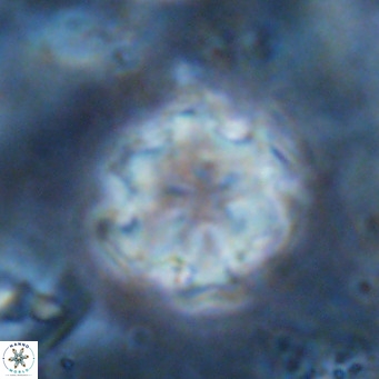Discoaster catillomicros VR 17990