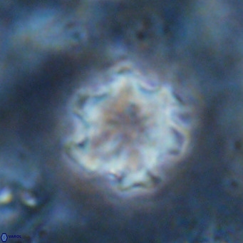 Discoaster catillomicros VR 17993