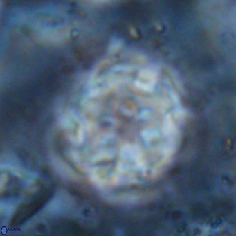 Discoaster catillomicros VR 17994