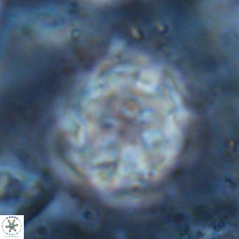 Discoaster catillomicros VR 17994
